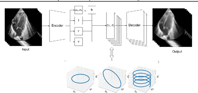 Figure 1 for Interpretable Anomaly Detection in Echocardiograms with Dynamic Variational Trajectory Models