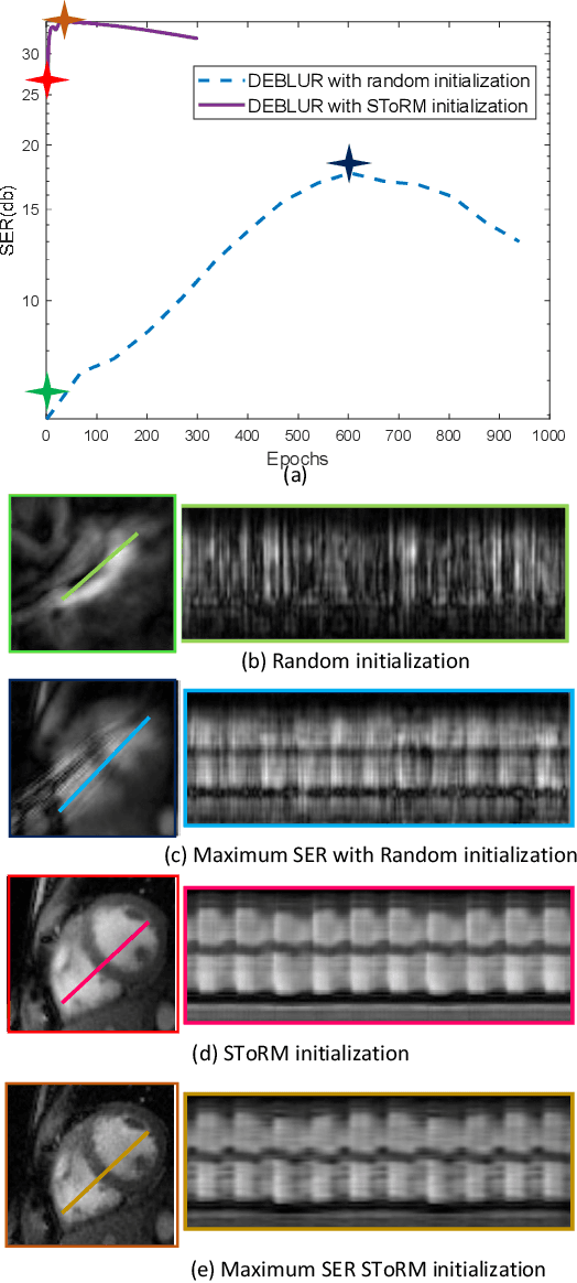 Figure 2 for Dynamic Imaging using Deep Bi-linear Unsupervised Regularization (DEBLUR)