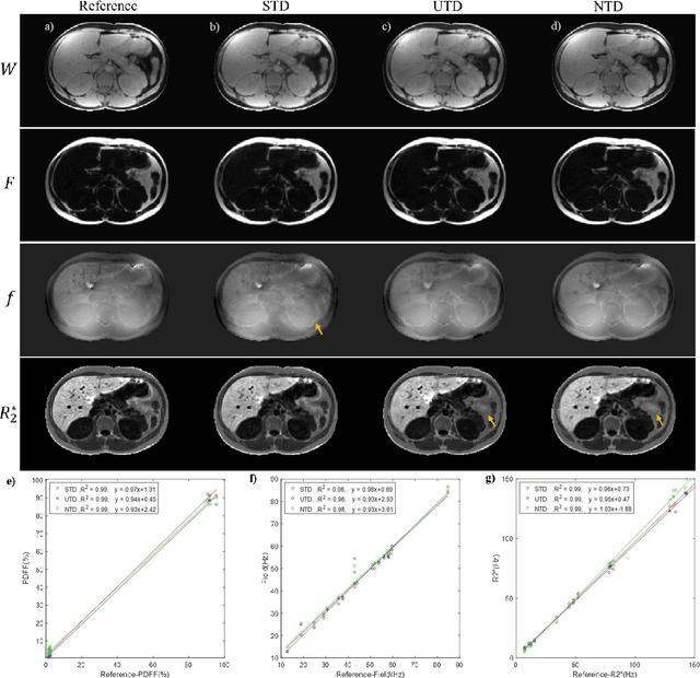 Figure 3 for Deep Neural Network  for Water/Fat Separation: Supervised Training, Unsupervised Training, and No Training