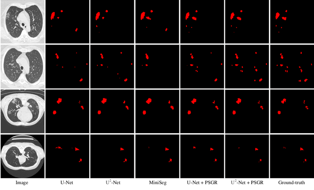 Figure 3 for PSGR: Pixel-wise Sparse Graph Reasoning for COVID-19 Pneumonia Segmentation in CT Images