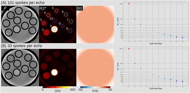 Figure 3 for Free-Breathing Water, Fat, $R_2^{\star}$ and $B_0$ Field Mapping of the Liver Using Multi-Echo Radial FLASH and Regularized Model-based Reconstruction