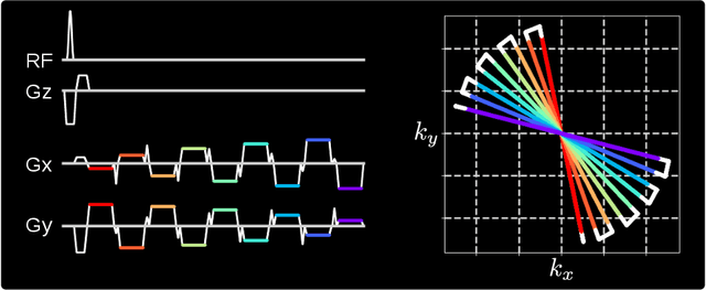Figure 1 for Free-Breathing Water, Fat, $R_2^{\star}$ and $B_0$ Field Mapping of the Liver Using Multi-Echo Radial FLASH and Regularized Model-based Reconstruction
