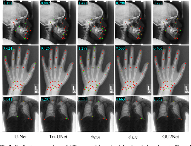 Figure 4 for You Only Learn Once: Universal Anatomical Landmark Detection