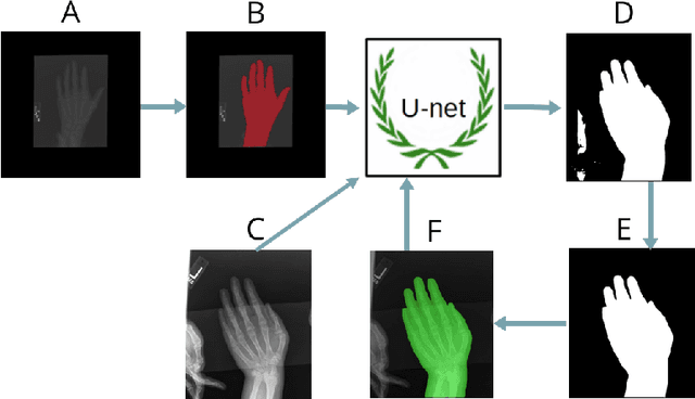 Figure 3 for Pediatric Bone Age Assessment Using Deep Convolutional Neural Networks