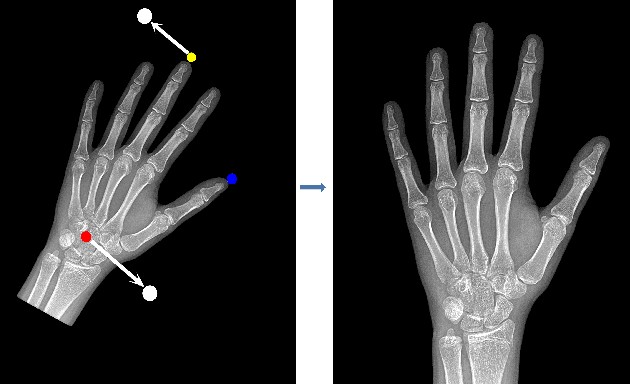Figure 4 for Pediatric Bone Age Assessment Using Deep Convolutional Neural Networks