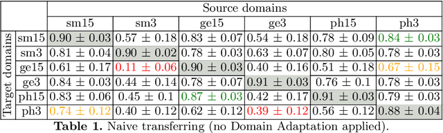 Figure 2 for Feather-Light Fourier Domain Adaptation in Magnetic Resonance Imaging