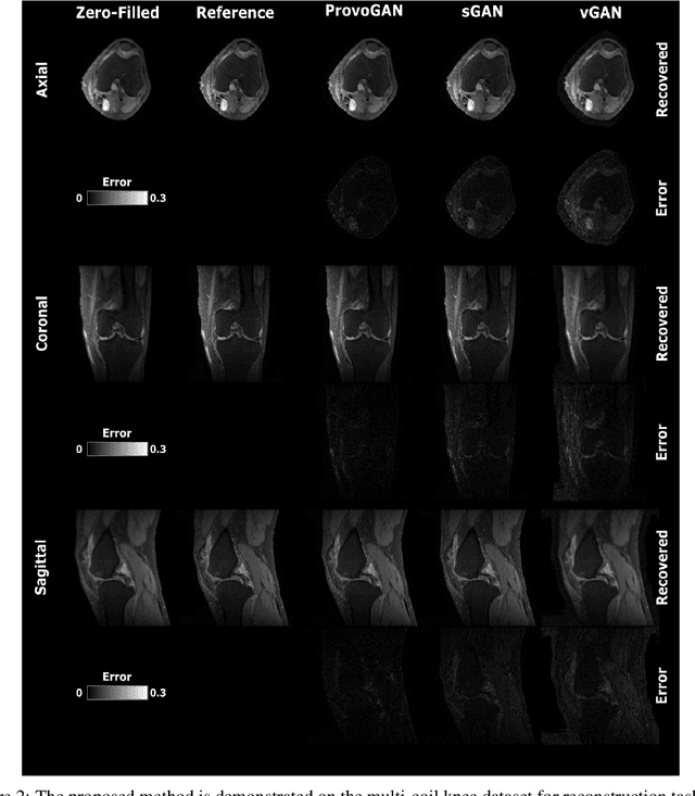 Figure 3 for Progressively Volumetrized Deep Generative Models for Data-Efficient Contextual Learning of MR Image Recovery
