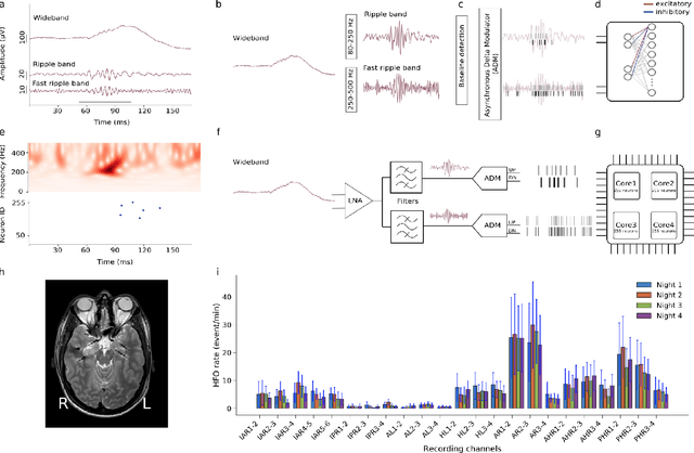 Figure 1 for An electronic neuromorphic system for real-time detection of High Frequency Oscillations (HFOs) in intracranial EEG