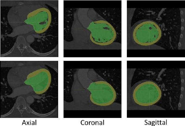 Figure 3 for Democratizing Artificial Intelligence in Healthcare: A Study of Model Development Across Two Institutions Incorporating Transfer Learning