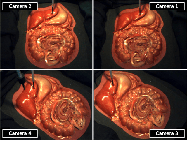 Figure 3 for A Recurrent Convolutional Neural Network Approach for Sensorless Force Estimation in Robotic Surgery
