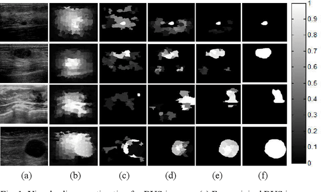 Figure 1 for Tumor Saliency Estimation for Breast Ultrasound Images via Breast Anatomy Modeling