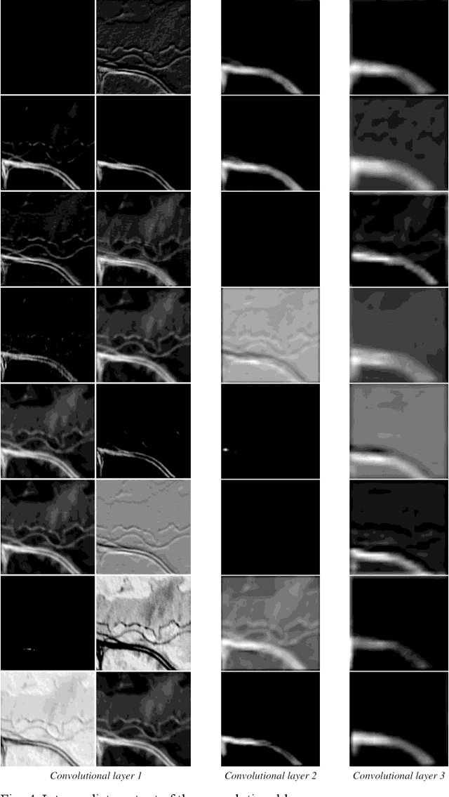 Figure 4 for Convolutional Autoencoder for Blind Hyperspectral Image Unmixing