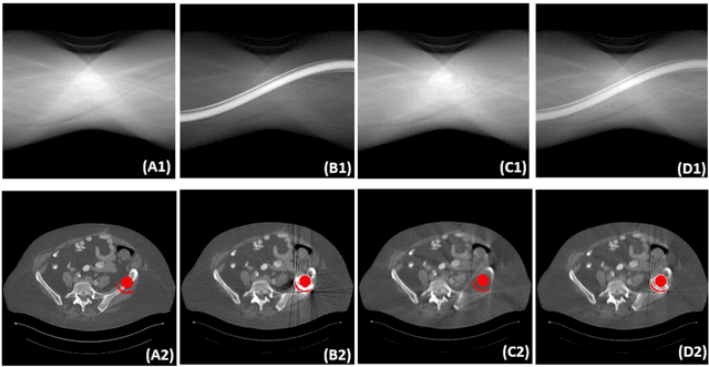 Figure 4 for DAN-Net: Dual-Domain Adaptive-Scaling Non-local Network for CT Metal Artifact Reduction