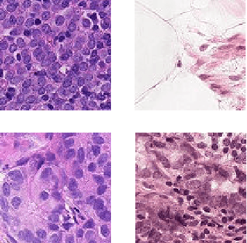 Figure 2 for Blind microscopy image denoising with a deep residual and multiscale encoder/decoder network