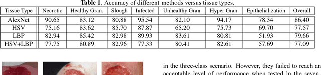 Figure 2 for Fine-grained wound tissue analysis using deep neural network