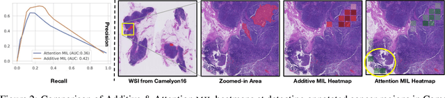 Figure 3 for Additive MIL: Intrinsic Interpretability for Pathology