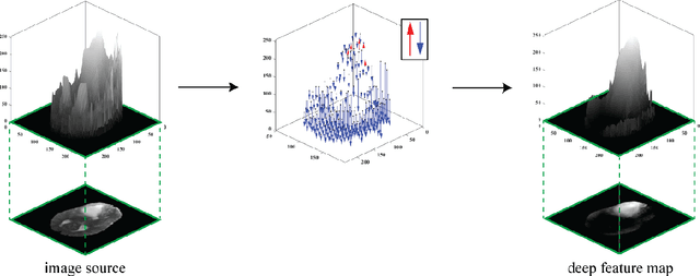 Figure 2 for A Neural Ordinary Differential Equation Model for Visualizing Deep Neural Network Behaviors in Multi-Parametric MRI based Glioma Segmentation