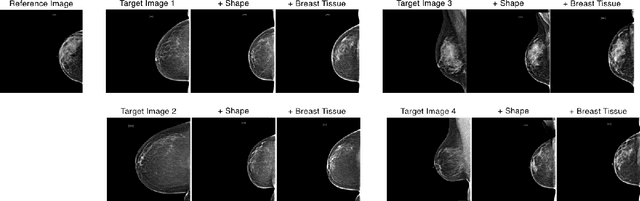 Figure 3 for MammoGANesis: Controlled Generation of High-Resolution Mammograms for Radiology Education