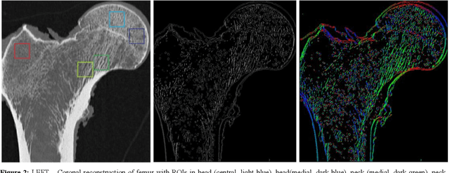 Figure 2 for Introducing Anisotropic Minkowski Functionals and Quantitative Anisotropy Measures for Local Structure Analysis in Biomedical Imaging