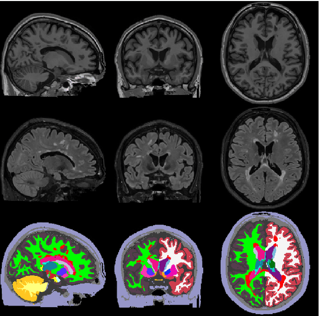 Figure 1 for A Contrast-Adaptive Method for Simultaneous Whole-Brain and Lesion Segmentation in Multiple Sclerosis