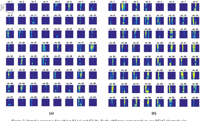 Figure 3 for Reconstructing Speech Stimuli From Human Auditory Cortex Activity Using a WaveNet Approach
