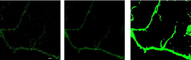 Figure 1 for Neuron detection in stack images: a persistent homology interpretation