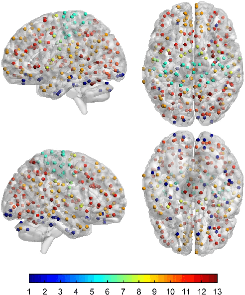 Figure 3 for Graph-aware linear mixed effects models for brain connectivity networks