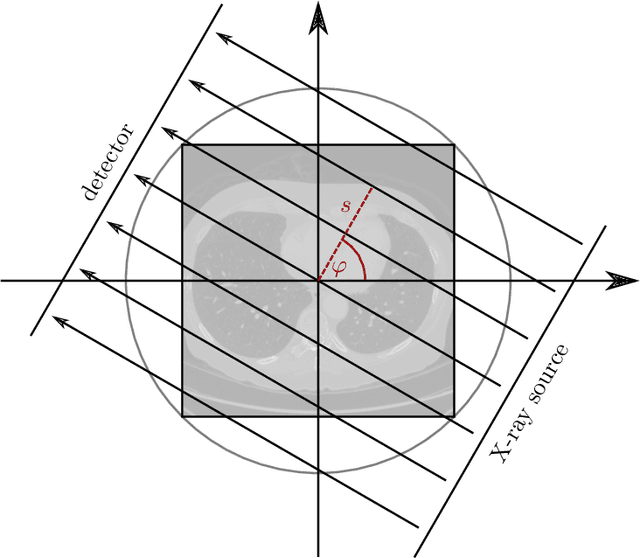 Figure 3 for The LoDoPaB-CT Dataset: A Benchmark Dataset for Low-Dose CT Reconstruction Methods