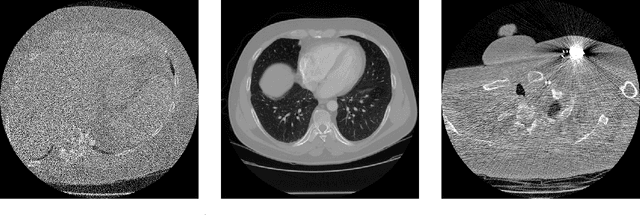 Figure 4 for The LoDoPaB-CT Dataset: A Benchmark Dataset for Low-Dose CT Reconstruction Methods
