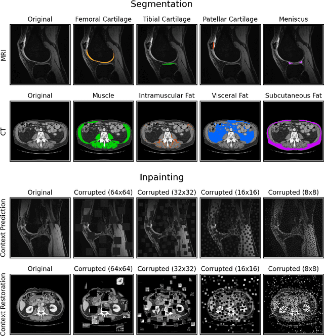 Figure 1 for Data-Limited Tissue Segmentation using Inpainting-Based Self-Supervised Learning