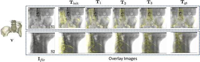 Figure 3 for Deep Iterative 2D/3D Registration