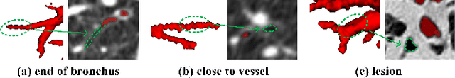 Figure 1 for BREAK: Bronchi Reconstruction by gEodesic transformation And sKeleton embedding