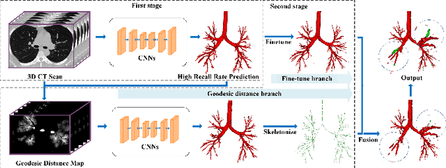 Figure 4 for BREAK: Bronchi Reconstruction by gEodesic transformation And sKeleton embedding