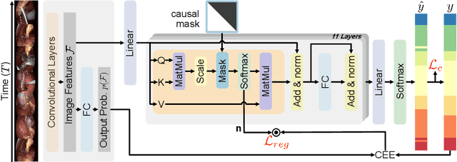 Figure 1 for OperA: Attention-Regularized Transformers for Surgical Phase Recognition