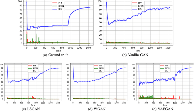 Figure 1 for On the Performance of Generative Adversarial Network (GAN) Variants: A Clinical Data Study