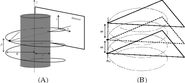 Figure 4 for Efficient Low Dose X-ray CT Reconstruction through Sparsity-Based MAP Modeling