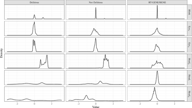 Figure 4 for Continuous Non-Invasive Eye Tracking In Intensive Care