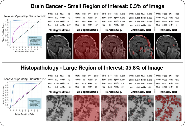 Figure 1 for Towards a Guideline for Evaluation Metrics in Medical Image Segmentation