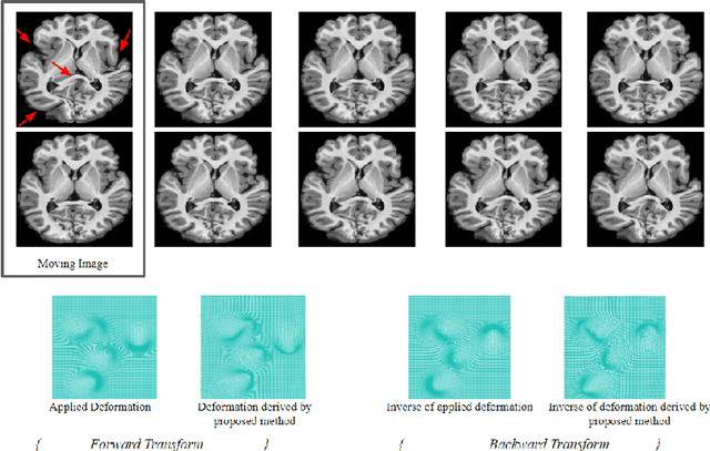 Figure 3 for A method for large diffeomorphic registration via broken geodesics