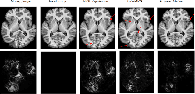 Figure 2 for A method for large diffeomorphic registration via broken geodesics