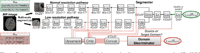 Figure 1 for Unsupervised domain adaptation in brain lesion segmentation with adversarial networks