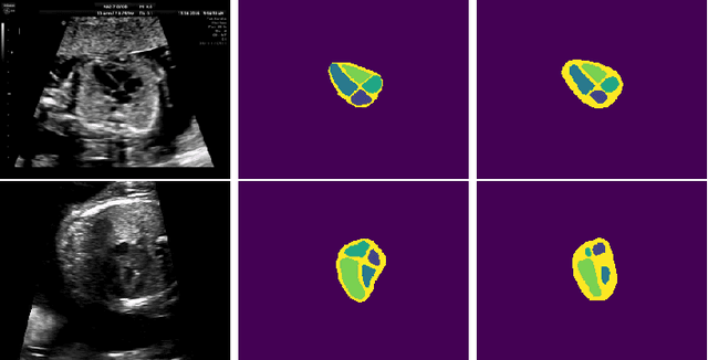 Figure 3 for Can non-specialists provide high quality gold standard labels in challenging modalities?