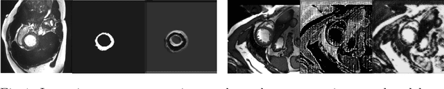 Figure 1 for Factorised spatial representation learning: application in semi-supervised myocardial segmentation
