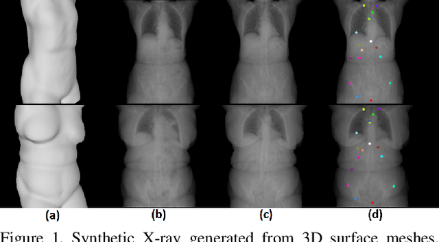 Figure 1 for Generating Synthetic X-ray Images of a Person from the Surface Geometry