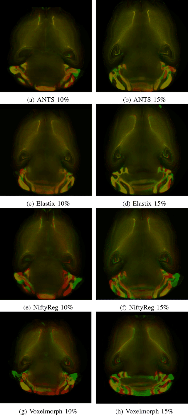 Figure 2 for A Comparative Analysis of Registration Tools: Traditional vs Deep Learning Approach on High Resolution Tissue Cleared Data