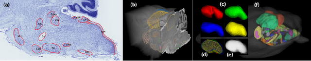 Figure 3 for The Active Atlas: Combining 3D Anatomical Models with Texture Detectors