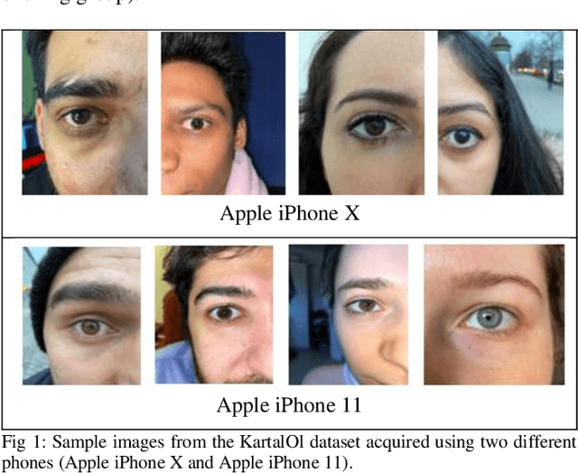 Figure 1 for KartalOl: Transfer learning using deep neural network for iris segmentation and localization: New dataset for iris segmentation