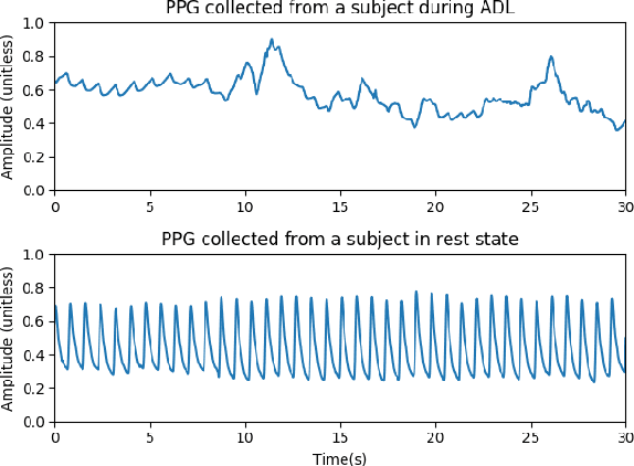 Figure 1 for Motion Artifact Reduction In Photoplethysmography For Reliable Signal Selection