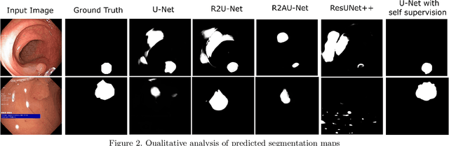 Figure 2 for Self-Supervised U-Net for Segmenting Flat and Sessile Polyps