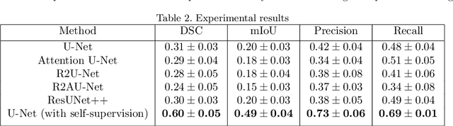 Figure 3 for Self-Supervised U-Net for Segmenting Flat and Sessile Polyps